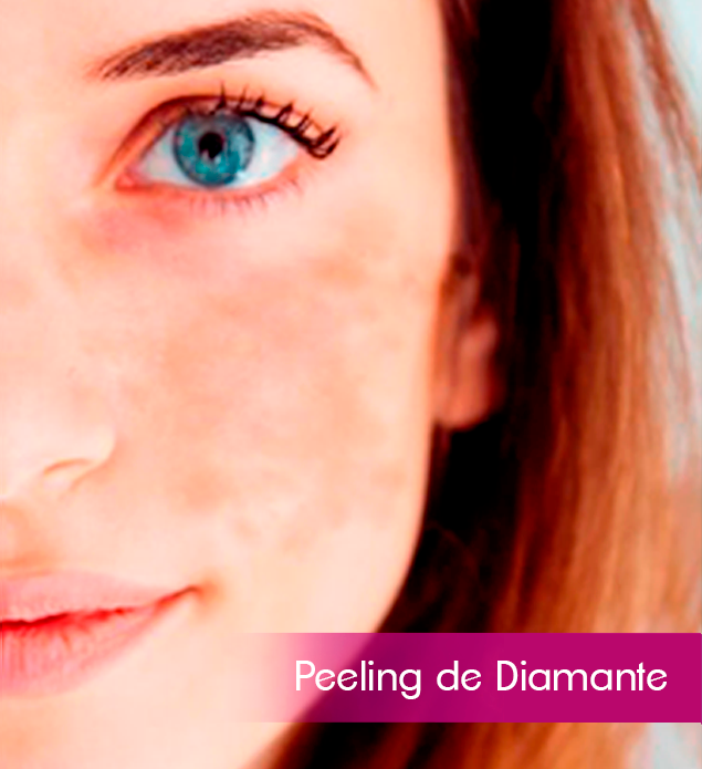tratamentos-faciais-peeling-de-diamante